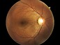 Eye Doctor photo in Dallas at 16731 Coit Road