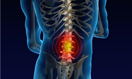 Advanced Chiropractic
