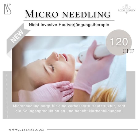 Micro Needling: Royal Beauty Dietikon GmbH - Beauty, Kosmetik und Körperpflege - 8953 Dietikon im Kanton Zürich