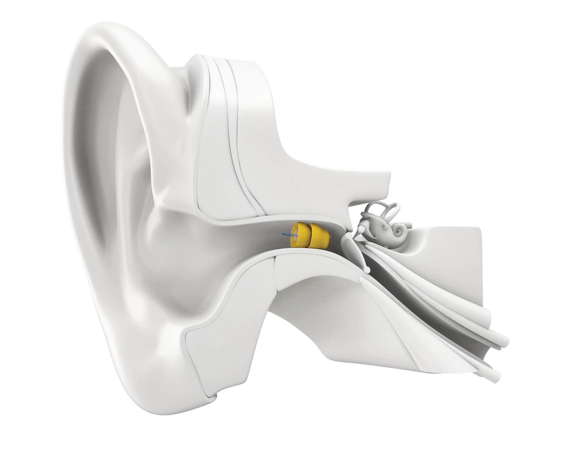 Lyric - Invisible hearing aid
