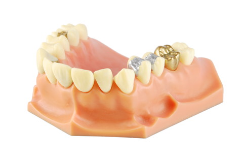 Linder Pro- Dental GmbH