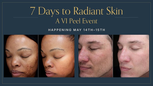 The VI Peel Event at Woodhouse Littleton May 14th - 15th