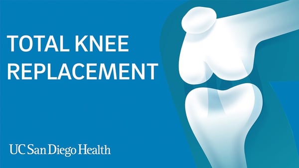 Image "Total Knee Replacement at UC San Diego Health"