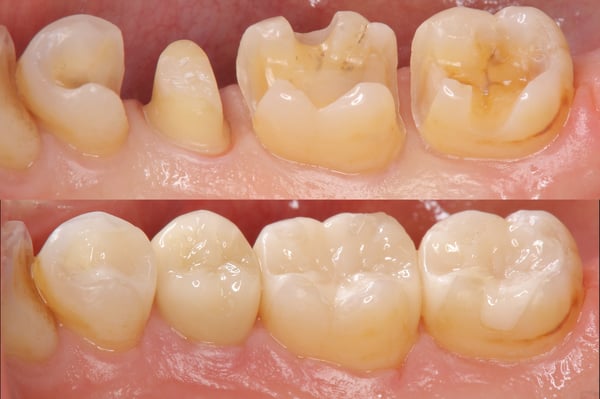 Traitements conservateurs de haute qualité par nos dentistes à la clinique dentaire de meyrin