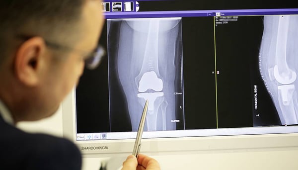 Knee scan orthopaedic care