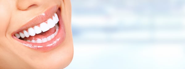 blanchiment dentaire clinique meyrin et genève par nos dentises