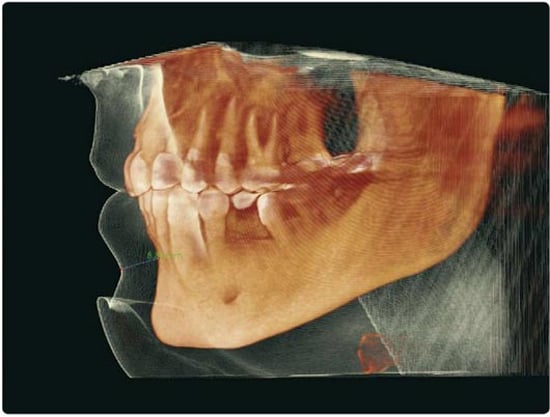 Zahnarztzentrum Wallisellen - Röntgen 3D Rendering