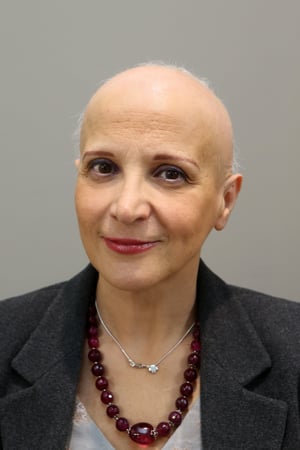 Alopecia femminile prima del trattamento con il Metodo CNC di CRLab