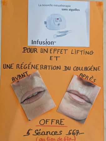 Promotion: soin réparateur après l'été