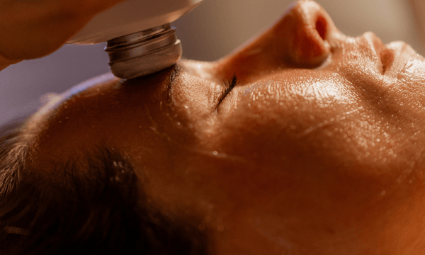 A close-up of a person receiving a Glacial Gloss facial, with a cooling handheld device applied to the forehead, highlighting smooth, refreshed skin.