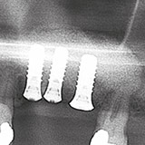 Gemeinschaftspraxis PIONIERPARK Kieferchirurgie Zahnpraxis Winterthur