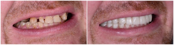 traitements dentaires avec techniques modernes à la clinique dentaire de Meyrin