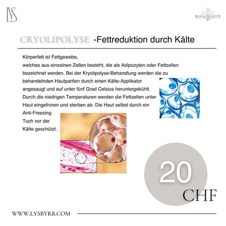 Cryolipolyse-Fettreduktion durch Kälte: Royal Beauty Dietikon GmbH - Beauty, Kosmetik und Körperpflege - 8953 Dietikon im Kanton Zürich