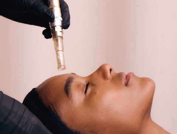 Nano channel hydra facial broomfield