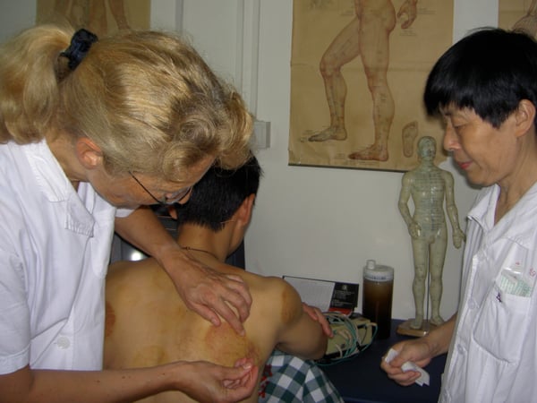 Akupunktur im Red Cross Hopital, Hangzhou