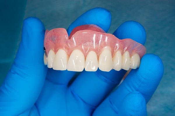 Prothèse dentaire adaptée et esthétique à la clinique dentaire de meyrin